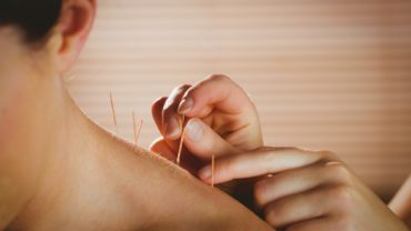 can acupuncture help with weight loss